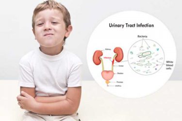 Urinary tract infections in children